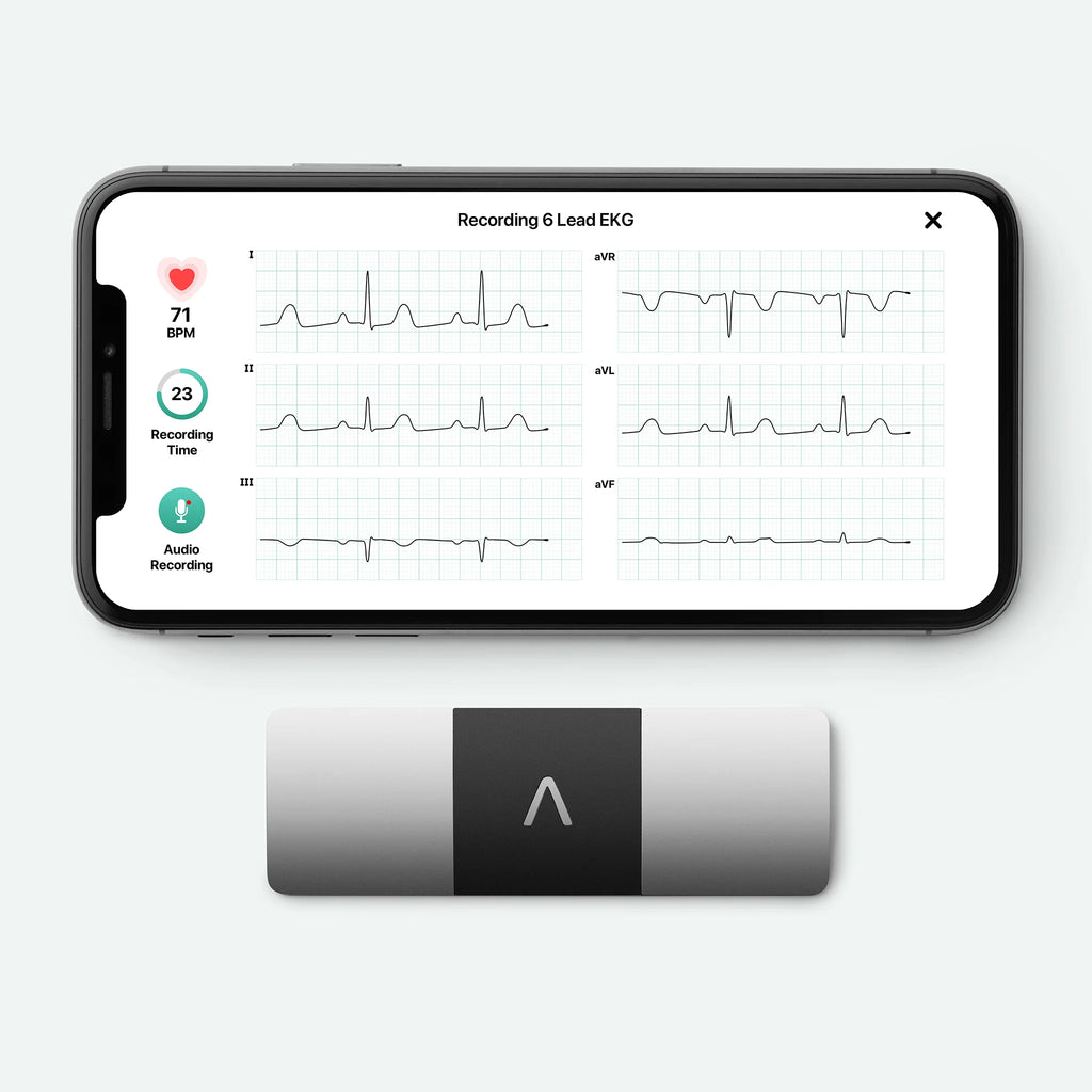 2026 2025 KardiaMobile 6L – Appareil ECG personnel à six dérivations