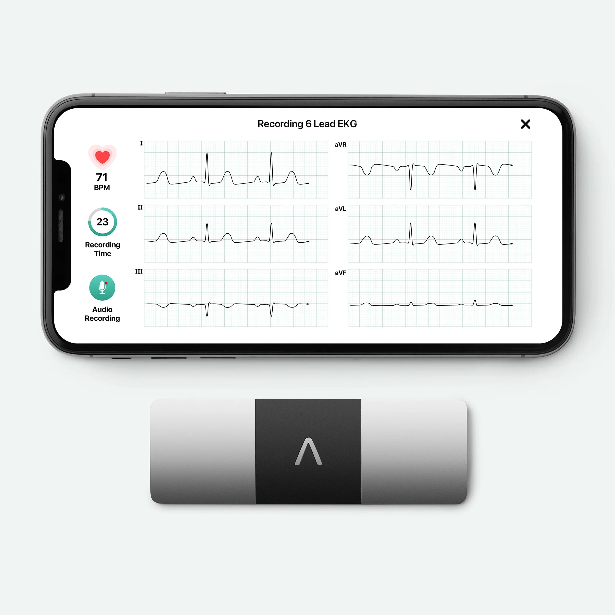2026 2025 KardiaMobile 6L – Appareil ECG personnel à six dérivations