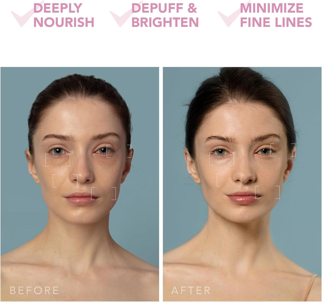 2026 2025 FOREO UFO 3 – Masque Visage Intelligent 5-en-1 avec LED, Thermothérapie, Cryothérapie et Massage T-Sonic – Édition Limitée Anti-Âge