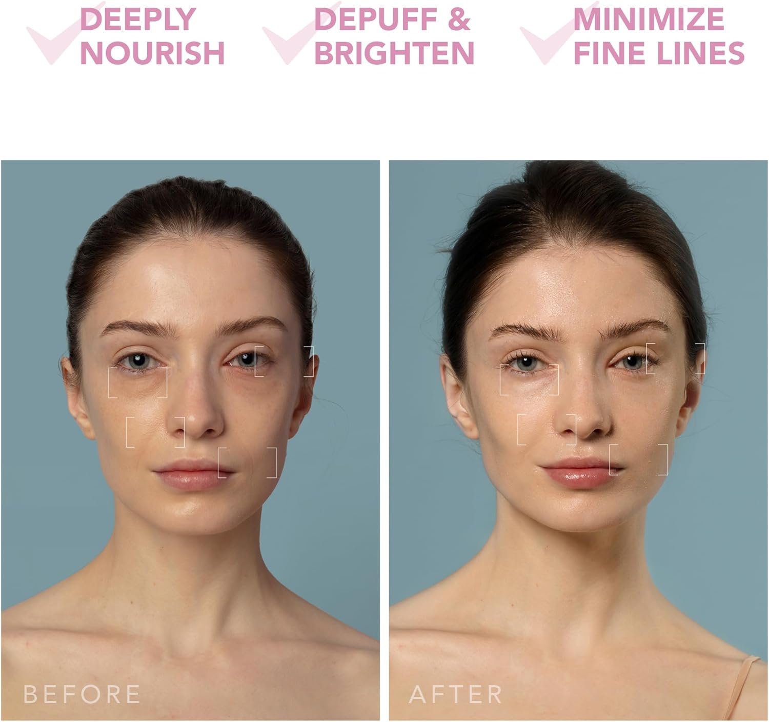2026 2025 FOREO UFO 3 – Masque Visage Intelligent 5-en-1 avec LED, Thermothérapie, Cryothérapie et Massage T-Sonic – Édition Limitée Anti-Âge