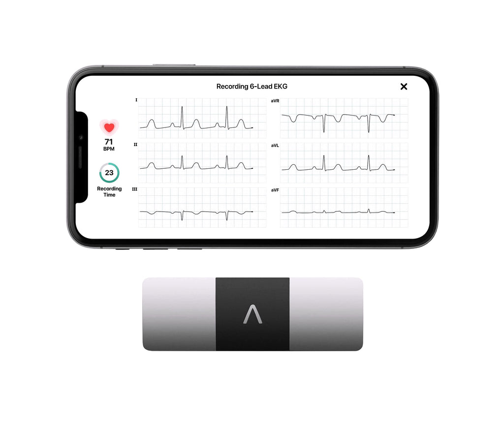 2026 KardiaMobile 6L Moniteur ECG personnel pour smartphones