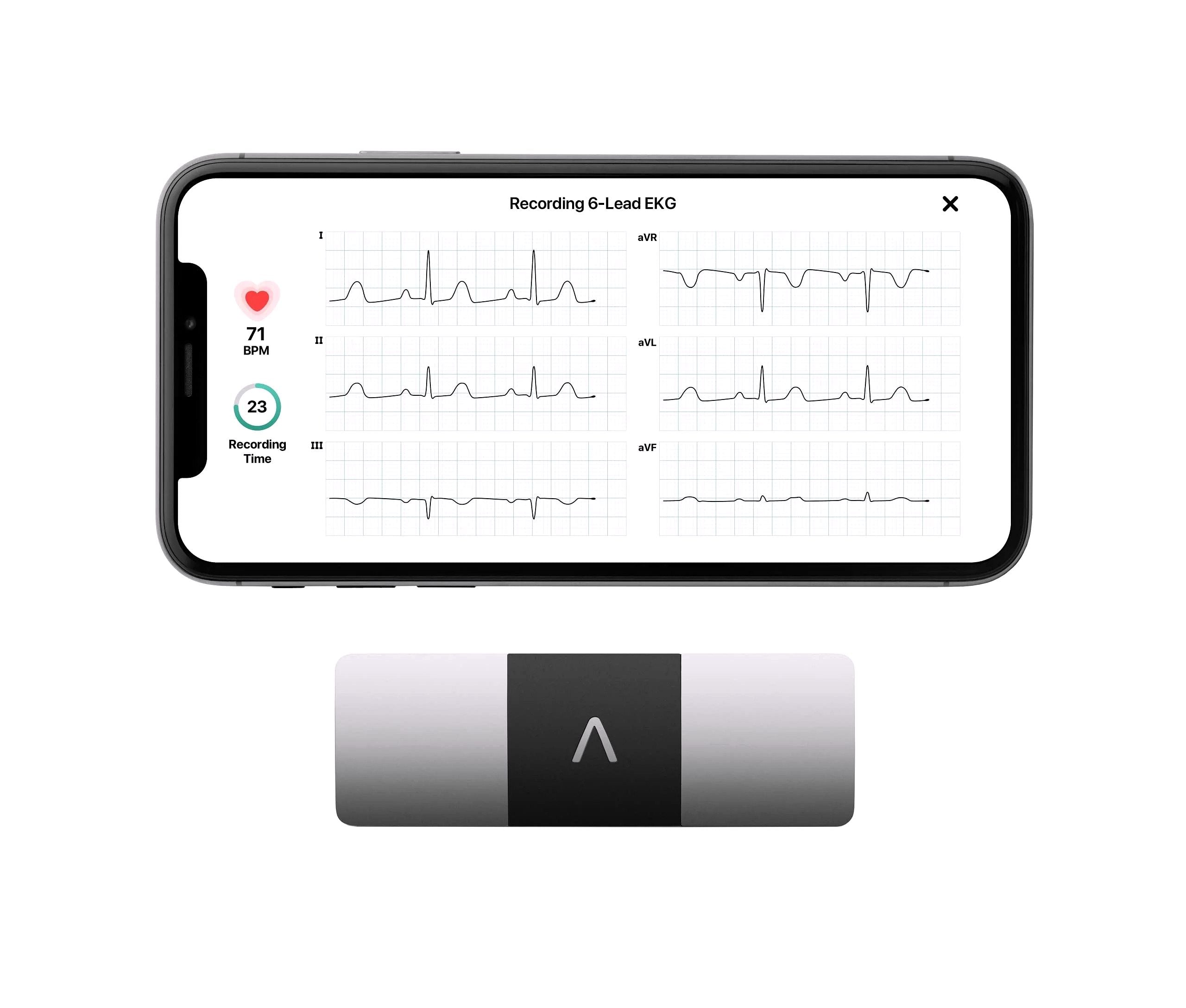 2026 KardiaMobile 6L Moniteur ECG personnel pour smartphones